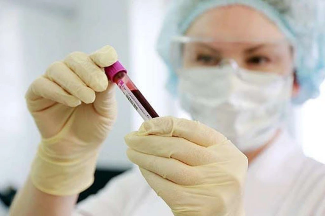 Azərbaycanda deputatların koronavirus testinin cavabı açıqlandı
