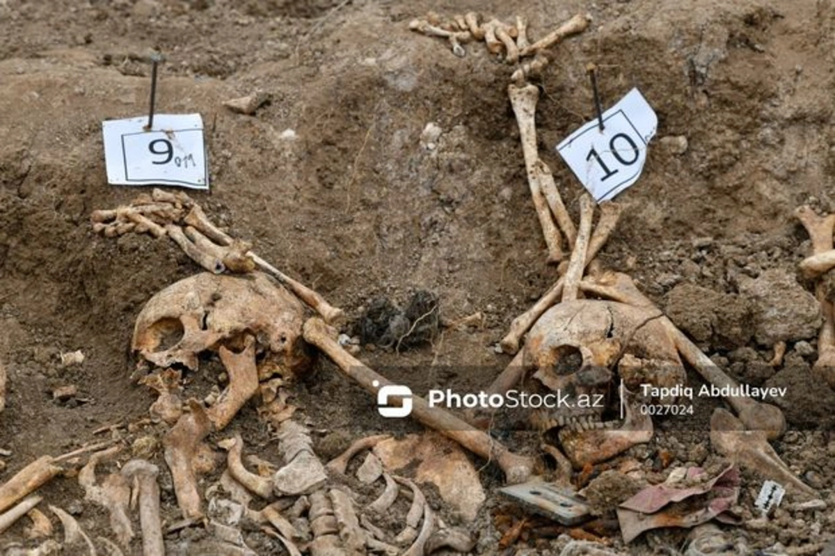 В обнаруженном в Ходжалы массовом захоронении найдены останки еще пяти человек
