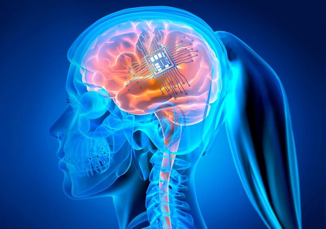 Конкурент Neuralink установил рекорд по числу электродов в мозге человека