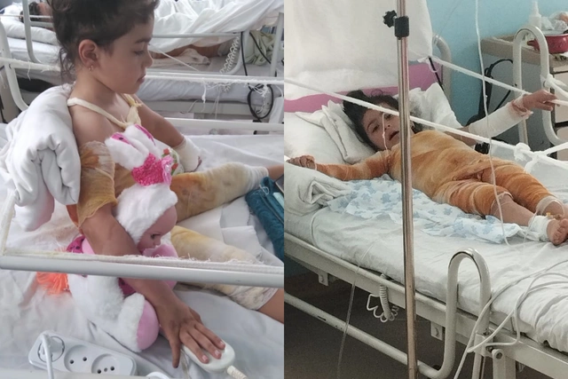 Пятилетняя Афсана получила тяжелые ожоги: малышке необходима помощь