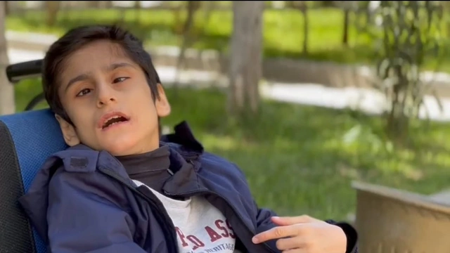 13-летний Гусейн нуждается в помощи: он получил травму из-за ошибки врача