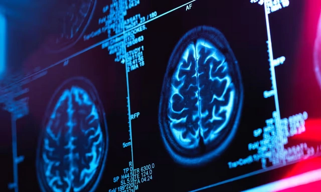 Канадский ученый обвинил власти в намеренном запрете на изучение загадочной болезни мозга
