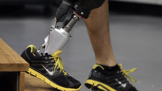 Создан бионический протез ноги, полностью управляемый нервной системой