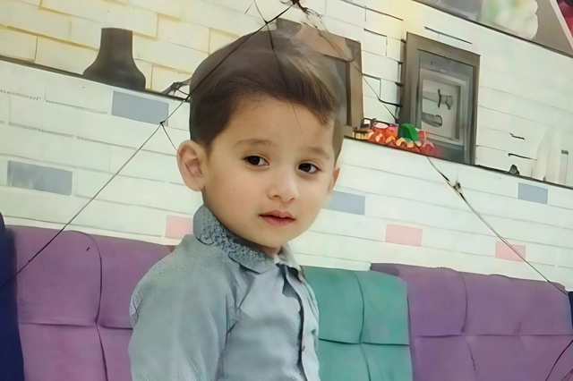 В Азербайджане пятилетний ребенок скончался после операции по удалению зуба