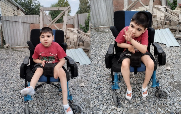 9-летний Юсиф нуждается в срочной операции: ребенку необходима помощь