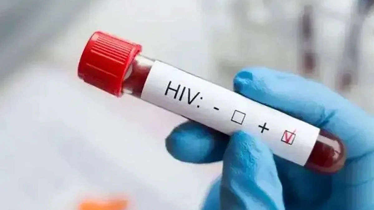 13 yaşındaki AIDS kurbanının ölümüne ilişkin Sağlık Müdürlüğü'nden açıklama