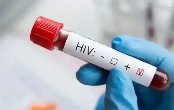 13 yaşındaki AIDS kurbanının ölümüne ilişkin Sağlık Müdürlüğü'nden açıklama