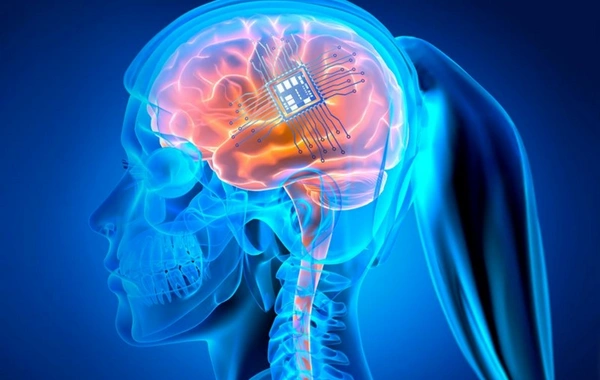 Neuralink çipi üçüncü hastaya implante edildi