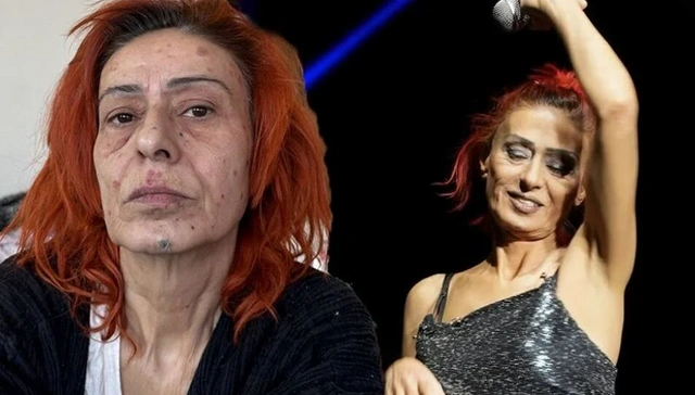 Yıldız Tilbe kimyasal yanığa maruz kaldı: Yüzünün son halini paylaştı