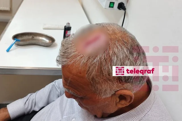 Məmur Şəkidə ciyər axşamında bələdiyyə sədrinin başına butulka çırpdı - Təfərrüat